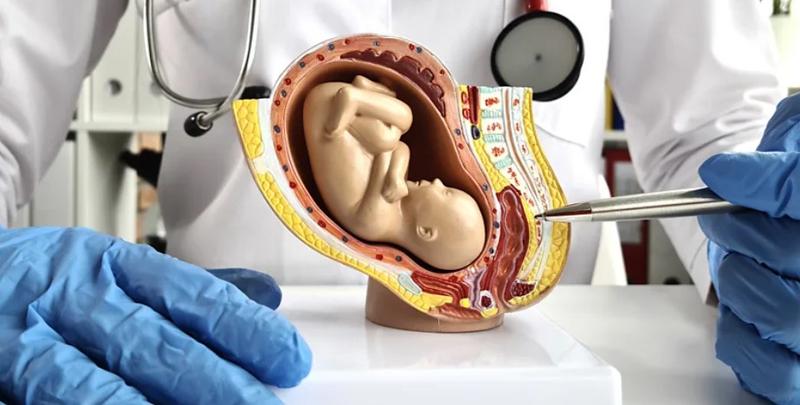 Artificial Placenta